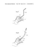 HIP JOINT INSTRUMENT AND METHOD diagram and image