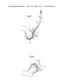 HIP JOINT INSTRUMENT AND METHOD diagram and image