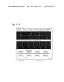 SYSTEM AND APPARATUS TO MONITOR BIOPACEMAKER MATURATION diagram and image