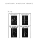 SYSTEM AND APPARATUS TO MONITOR BIOPACEMAKER MATURATION diagram and image