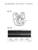 SYSTEM AND APPARATUS TO MONITOR BIOPACEMAKER MATURATION diagram and image