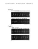 SYSTEM AND APPARATUS TO MONITOR BIOPACEMAKER MATURATION diagram and image