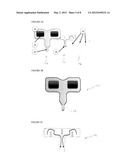 THERMOSTIMULATION APPARATUS diagram and image