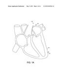 LEADLESS CARDIAC PACEMAKER WITH CONDUCTED COMMUNICATION diagram and image