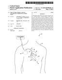 IMPLANTABLE MEDICAL DEVICE TELEMETRY IN DISRUPTIVE ENERGY FIELD diagram and image