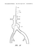 APPARATUS AND METHOD OF PLACEMENT OF A GRAFT OR GRAFT SYSTEM diagram and image