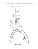 APPARATUS AND METHOD OF PLACEMENT OF A GRAFT OR GRAFT SYSTEM diagram and image