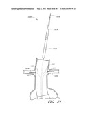 APPARATUS AND METHOD OF PLACEMENT OF A GRAFT OR GRAFT SYSTEM diagram and image