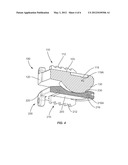 SPINAL IMPLANT diagram and image