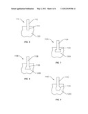 SPINAL IMPLANT diagram and image