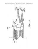 AUTOFOCUS AND/OR AUTOSCALING IN TELESURGERY diagram and image