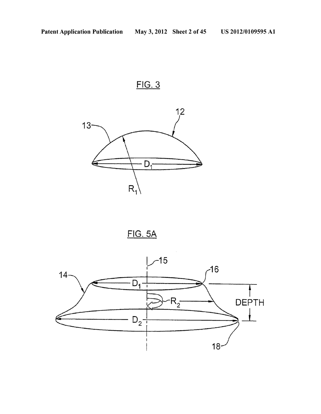 CONTACT LENS AND METHODS OF MANUFACTURE AND FITTING SUCH LENSES AND     COMPUTER PROGRAM PRODUCT - diagram, schematic, and image 03