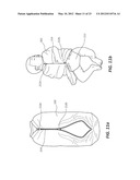 Swaddling Enclosure and Methods of Use and Manufacture Thereof diagram and image