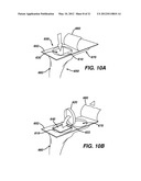 Medical Device With Feature For Sterile Acceptance Of Non-Sterile Reusable     Component diagram and image