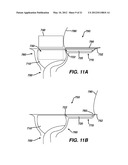 Medical Device With Feature For Sterile Acceptance Of Non-Sterile Reusable     Component diagram and image