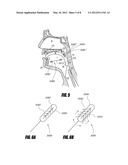 AIRWAY IMPLANTS AND METHODS AND DEVICES FOR INSERTION AND RETRIEVAL diagram and image