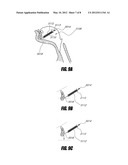 AIRWAY IMPLANTS AND METHODS AND DEVICES FOR INSERTION AND RETRIEVAL diagram and image