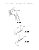 AIRWAY IMPLANTS AND METHODS AND DEVICES FOR INSERTION AND RETRIEVAL diagram and image