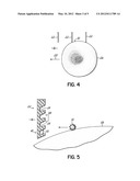 Anti-Viral Device diagram and image