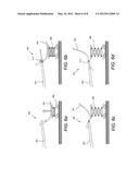 Wing tip device attachment apparatus and method diagram and image