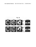 Transceiver apparatus, system and methodology for superior In-Vivo imaging     of human anatomy diagram and image