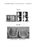 Transceiver apparatus, system and methodology for superior In-Vivo imaging     of human anatomy diagram and image
