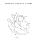 ULTRASOUND IMAGE PROCESSING TO RENDER THREE-DIMENSIONAL IMAGES FROM     TWO-DIMENSIONAL IMAGES diagram and image