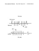 ULTRASOUND IMAGE PROCESSING TO RENDER THREE-DIMENSIONAL IMAGES FROM     TWO-DIMENSIONAL IMAGES diagram and image