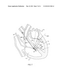 ULTRASOUND IMAGE PROCESSING TO RENDER THREE-DIMENSIONAL IMAGES FROM     TWO-DIMENSIONAL IMAGES diagram and image