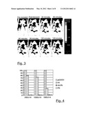 PROCESS FOR THE SYNTHESIS OF CONJUGATES OF GLYCOSAMINOGLYCANES (GAG) WITH     BIOLOGICALLY ACTIVE MOLECULES, POLYMERIC CONJUGATES AND RELATIVE USES     THEREOF diagram and image