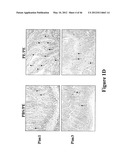 METHODS TO TREAT ALLERGIC CONDITIONS diagram and image