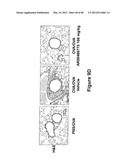 METHODS TO TREAT ALLERGIC CONDITIONS diagram and image