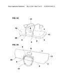 Stable Exercise Apparatus diagram and image