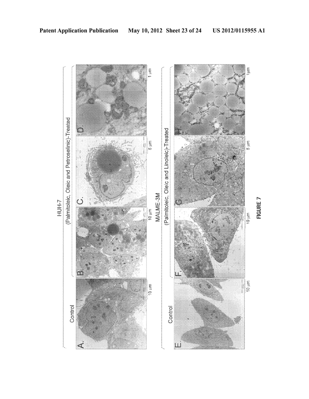 Methods for tumor treatment and adipogenesis differentiation - diagram, schematic, and image 24