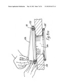 RETRACTOR diagram and image