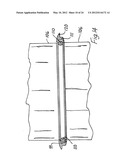 RETRACTOR diagram and image