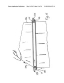 RETRACTOR diagram and image