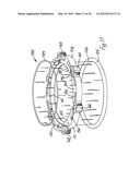 RETRACTOR diagram and image