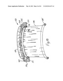 RETRACTOR diagram and image