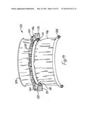 RETRACTOR diagram and image