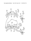 RETRACTOR diagram and image