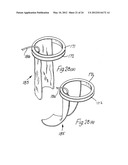 RETRACTOR diagram and image