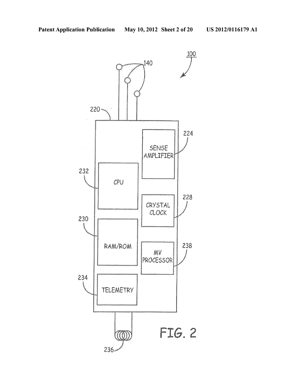 TECHNIQUES FOR DATA RETENTION UPON DETECTION OF AN EVENT IN AN IMPLANTABLE     MEDICAL DEVICE - diagram, schematic, and image 03