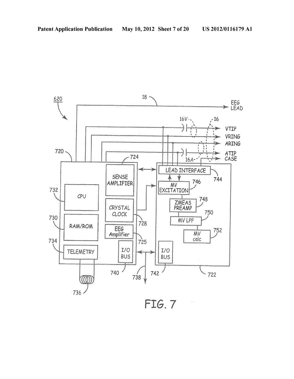 TECHNIQUES FOR DATA RETENTION UPON DETECTION OF AN EVENT IN AN IMPLANTABLE     MEDICAL DEVICE - diagram, schematic, and image 08