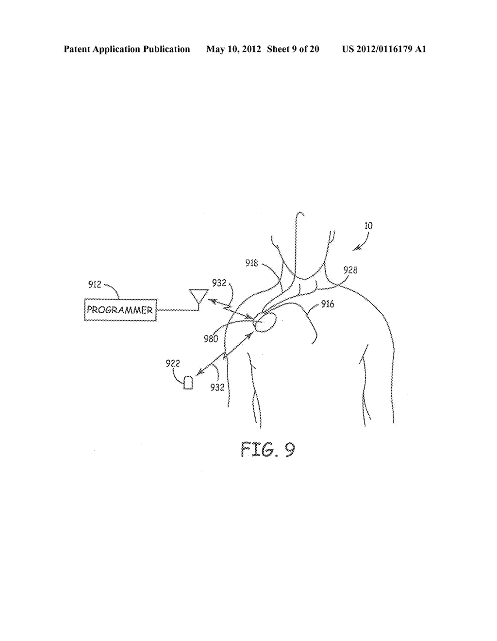 TECHNIQUES FOR DATA RETENTION UPON DETECTION OF AN EVENT IN AN IMPLANTABLE     MEDICAL DEVICE - diagram, schematic, and image 10