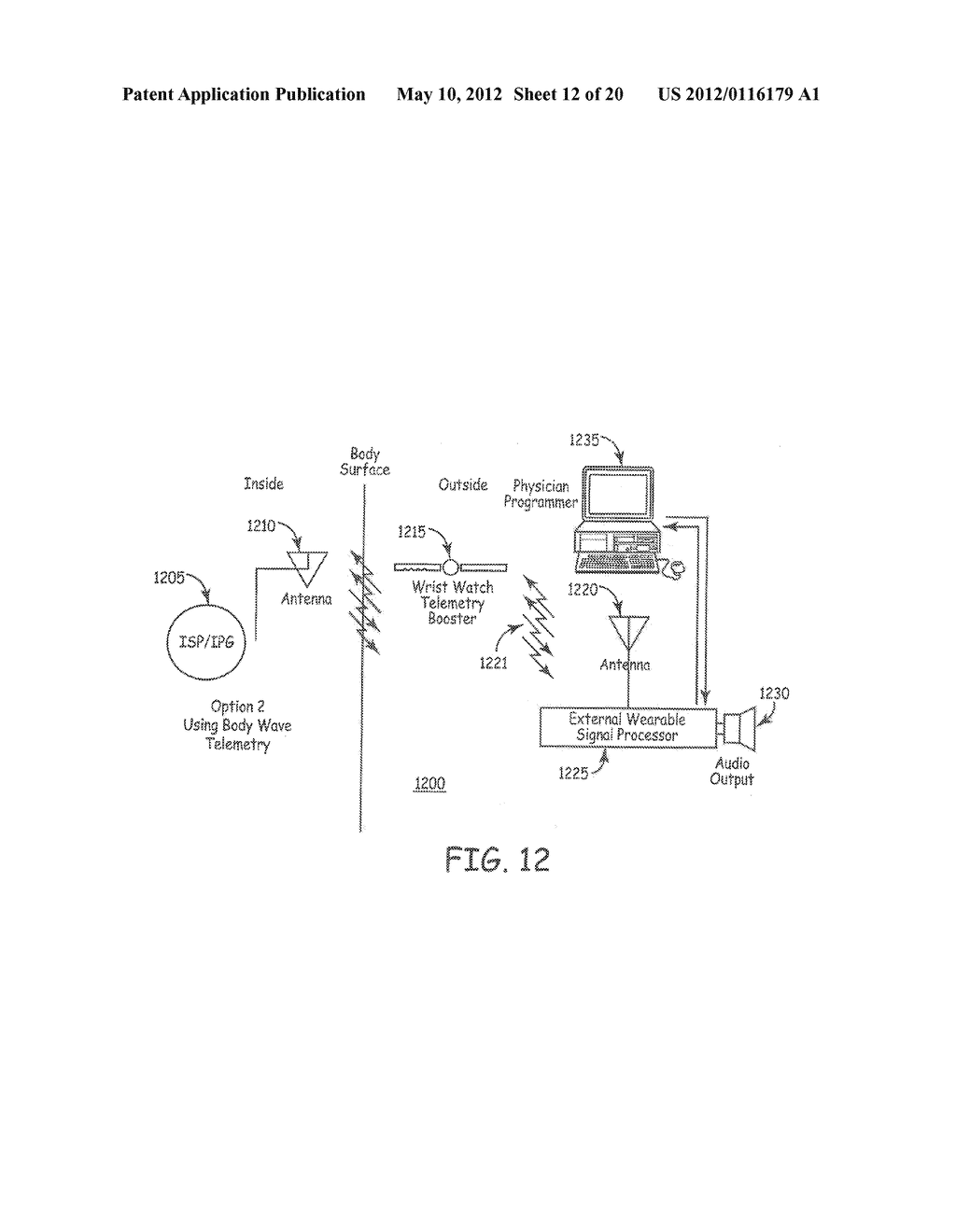 TECHNIQUES FOR DATA RETENTION UPON DETECTION OF AN EVENT IN AN IMPLANTABLE     MEDICAL DEVICE - diagram, schematic, and image 13