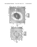 TEMPERATURE MEASUREMENT NEAR AN ICE BALL USING A PROTON RESONANCE     FREQUENCY METHOD AND RECALCULATION OF SUSCEPTIBILITY ARTIFACTS diagram and image