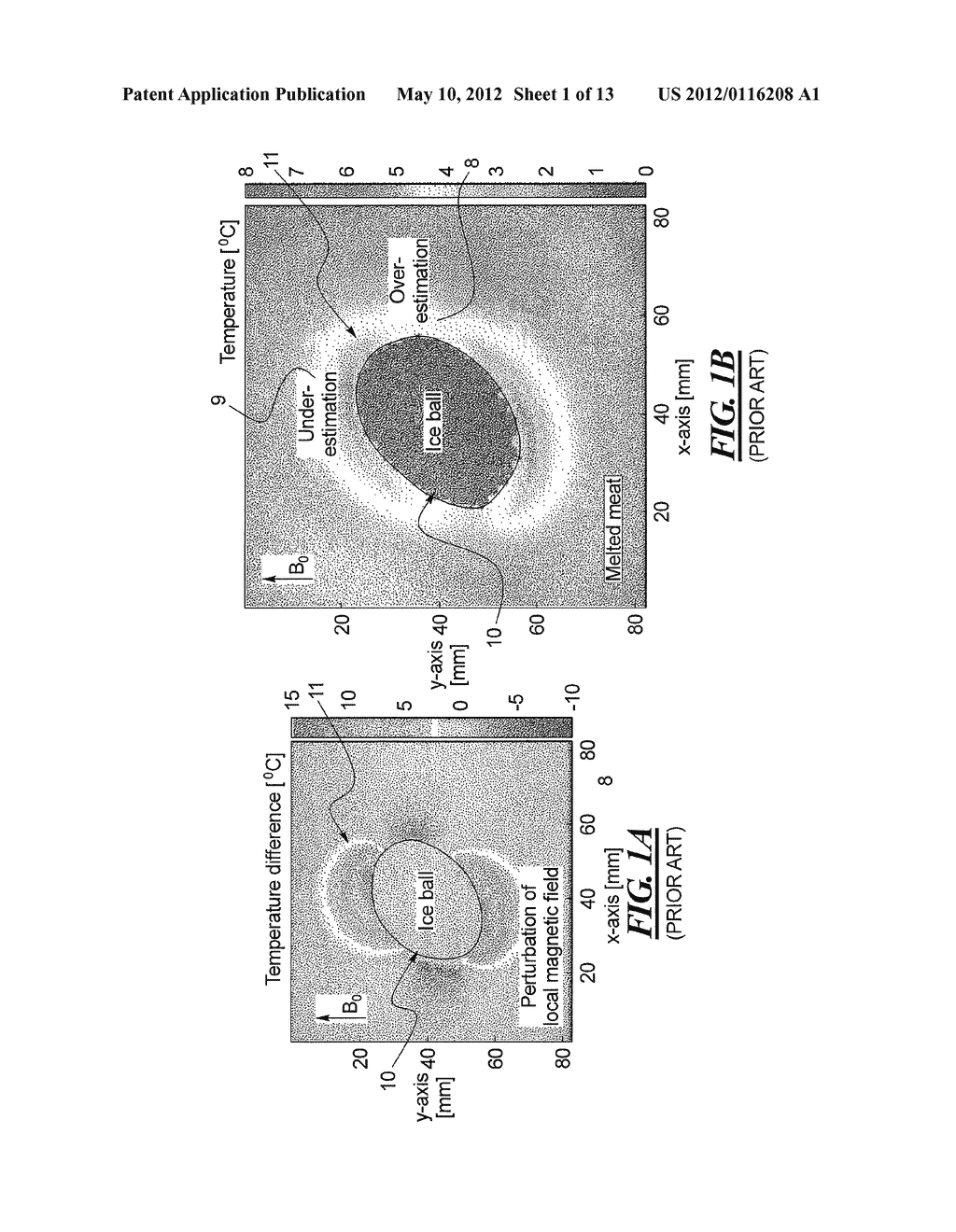 TEMPERATURE MEASUREMENT NEAR AN ICE BALL USING A PROTON RESONANCE     FREQUENCY METHOD AND RECALCULATION OF SUSCEPTIBILITY ARTIFACTS - diagram, schematic, and image 02