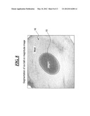 TEMPERATURE MEASUREMENT NEAR AN ICE BALL USING A PROTON RESONANCE     FREQUENCY METHOD AND RECALCULATION OF SUSCEPTIBILITY ARTIFACTS diagram and image