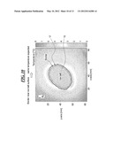 TEMPERATURE MEASUREMENT NEAR AN ICE BALL USING A PROTON RESONANCE     FREQUENCY METHOD AND RECALCULATION OF SUSCEPTIBILITY ARTIFACTS diagram and image